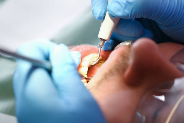 Best Emergency Tooth Extraction in Lake Como, NJ