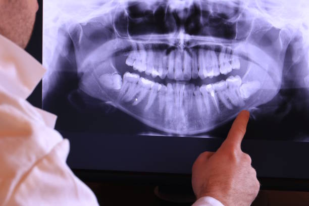 Best Emergency Treatment for Toothache in Lake Como, NJ