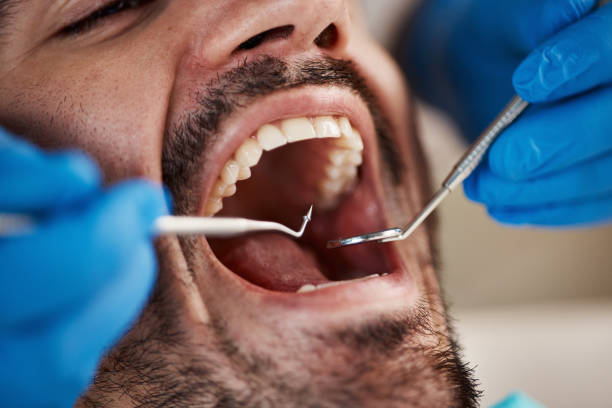 Best Emergency Broken Tooth Repair in Lake Como, NJ